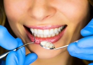 Металлокерамические коронки: доступное протезирование зубов